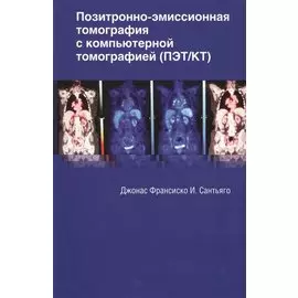Позитронно-эмиссионная томография с компьютерной томографией (ПЭТ/КТ)