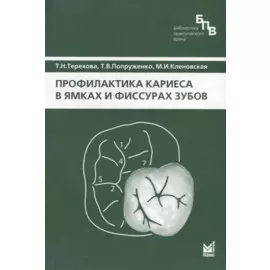 Профилактика кариеса в ямках и фиссурах зубов