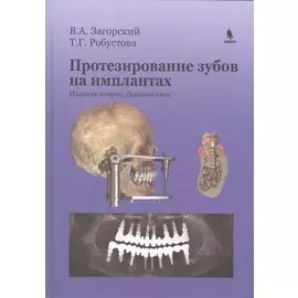 Протезирование зубов на имплантатах. Изд. 2-е, дополненное
