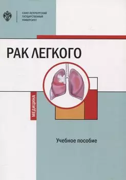 Рак легкого