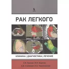 Рак легкого. Клиника, диагностика, лечение