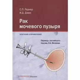 Рак мочевого пузыря. Краткий справочник