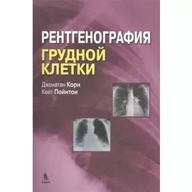 Рентгенография грудной клетки