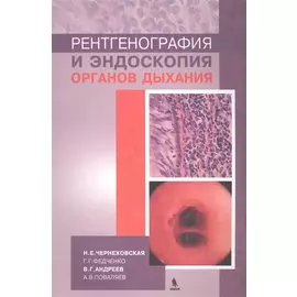 Рентгенография и эндоскопия органов дыхания