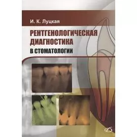 Рентгенологическая диагностика в стоматологии
