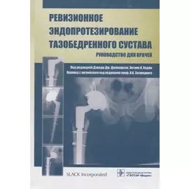 Ревизионное эндопротезирование тазобедренного сустава. Руководство для врачей