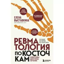 Ревматология по косточкам. Симптомы, диагнозы, лечение