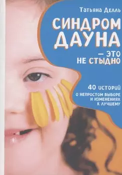 Синдром Дауна - это не стыдно: Как быть рядом с особенным ребенком и не потерять себя. 40 историй о непростом выборе и изменениях к лучшему
