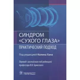 Синдром "сухого глаза". Практический подход