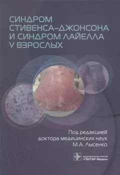 Синдром Стивенса–Джонсона и синдром Лайелла у взрослых
