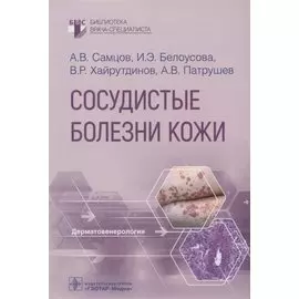 Сосудистые болезни кожи