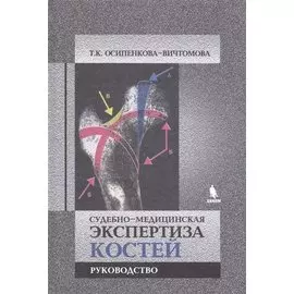 Судебно-медицинская экспертиза костей