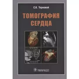 Томография сердца