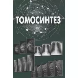 Томосинтез