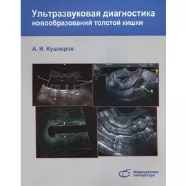 Ультразвуковая диагностика новообразований толстой кишки
