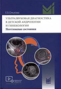 Ультразвуковая диагностика в детской андрологии и гинекологии. Неотложные состояния