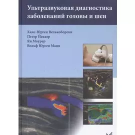 Ультразвуковая диагностика заболеваний головы и шеи