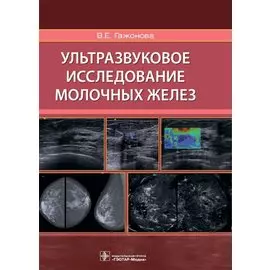 Ультразвуковое исследование молочных желез