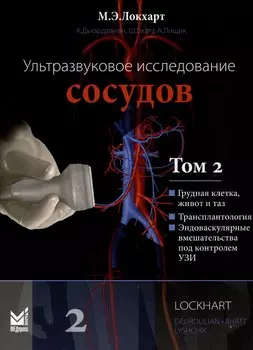 Ультразвуковое исследование сосудов. Том 2