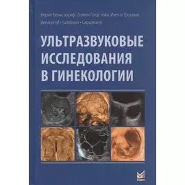 Ультразвуковые исследования в гинекологии