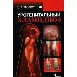 Урогенитальный хламидиоз