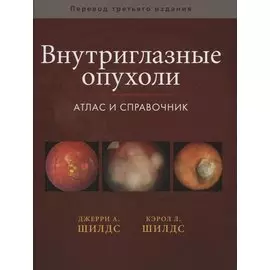 Внутриглазные опухоли. Атлас и справочник