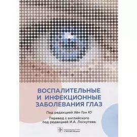 Воспалительные и инфекционные заболевания глаз