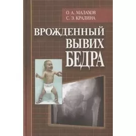 Врожденный вывих бедра (клиническая картина, диагностика, консервативное лечение)