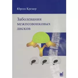 Заболевания межпозвонковых дисков