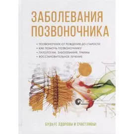 Заболевания позвоночника