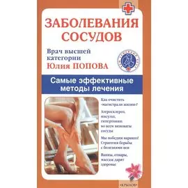 Заболевания сосудов. Самые эффективные методы лечения