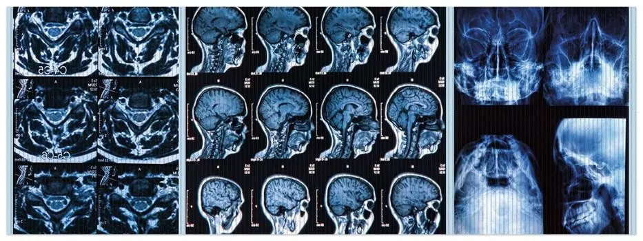 Коврик для душа Wallario, нескользящий коврик, коврик для ванной, коврик для двери, рентгеновские снимки головы человека со всех сторон, размер ок. 180 х 65 см, синий