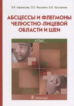 Абсцессы и флегмоны челюстно-лицевой области и шеи 18-19г.