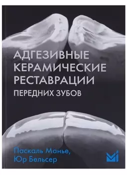 Адгезивные керамические реставрации передних зубов