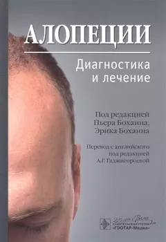 Алопеции. Диагностика и лечение