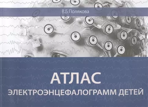 Атлас электроэнцефалограмм детей