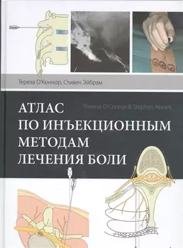 Атлас по инъекционным методам лечения боли