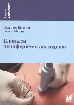 Блокады периферических нервов