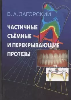 Частичные съемные и перекрывающие протезы. Морфология и ультраструктура