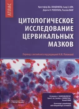 Цитологическое исследование цервикальных мазков Атлас (Ванденбуш)