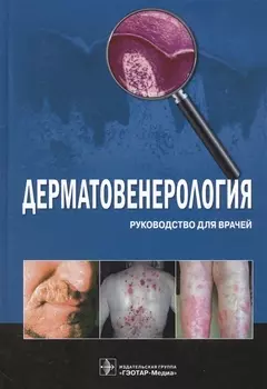 Дерматовенерология. Руководство для врачей