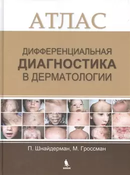 Дифференциальная диагностика в дерматологии. Атлас