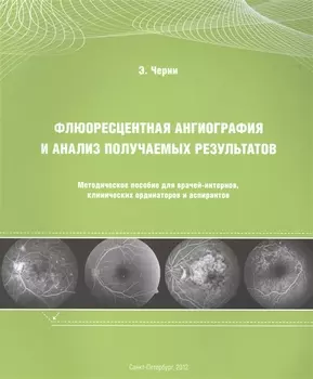 Флюоресцентная ангиография и анализ получаемых результатов: Методическое пособие для врачей-интернов, клинических ординаторов и аспирантов