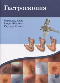 Гастроскопия