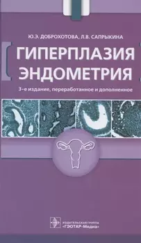 Гиперплазия эндометрия