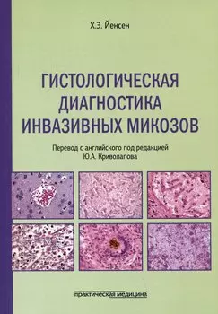 Гистологическая диагностика инвазивных микозов