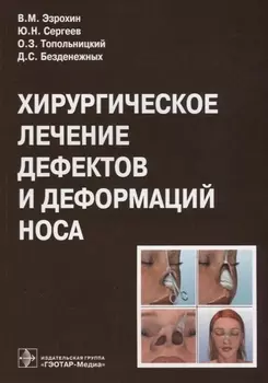 Хирургическое лечение дефектов и деформаций носа