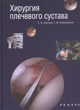 Хирургия плечевого сустава