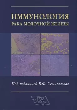 Иммунология рака молочной железы