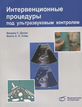 Интервенционные процедуры под ультразвуковым контролем (м) Догра